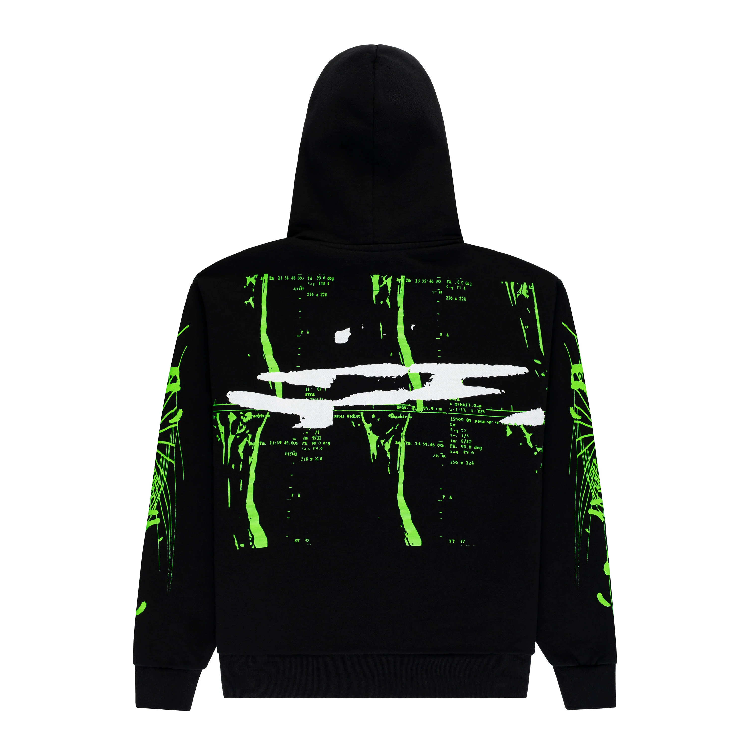X-RAY HOODIE - Image 2